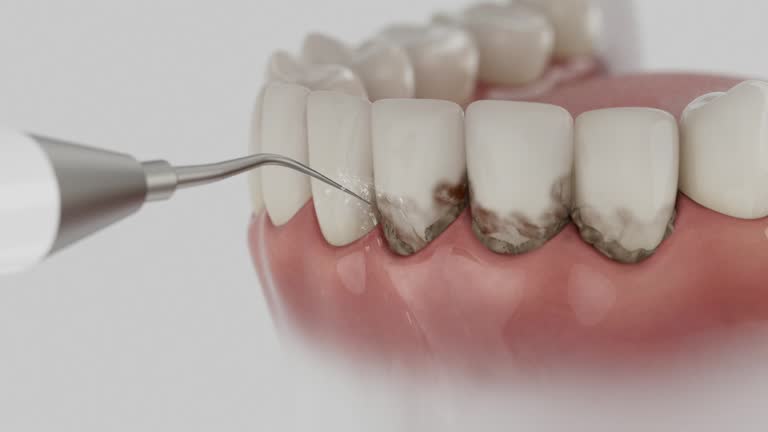 Trusted Tooth Extraction service in Lancaster, KY - Dentist Open Now